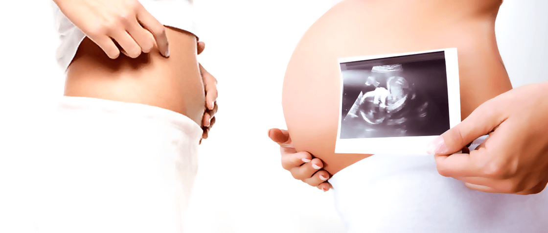 Two pregnant women, the right one is holding baby scan next to her belly