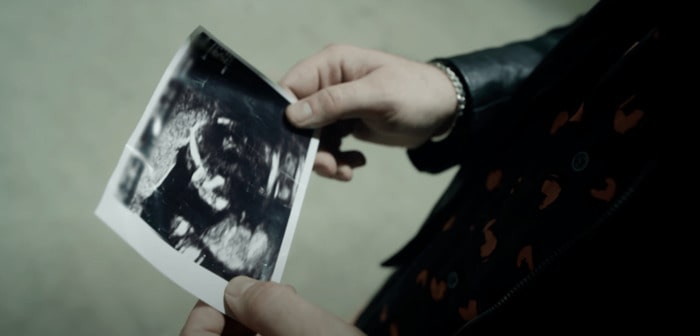 James Arthur holding a baby scan